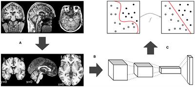 Alzheimer's Disease Detection Through Whole-Brain 3D-CNN MRI